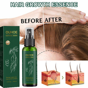 ⭐ MILAGROSO ELIXIR ( OUHOE ) PARA EL CRECIMIENTO DE CABELLO⭐